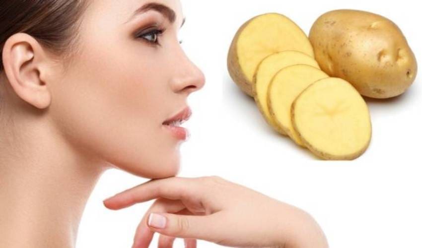 Potatoes