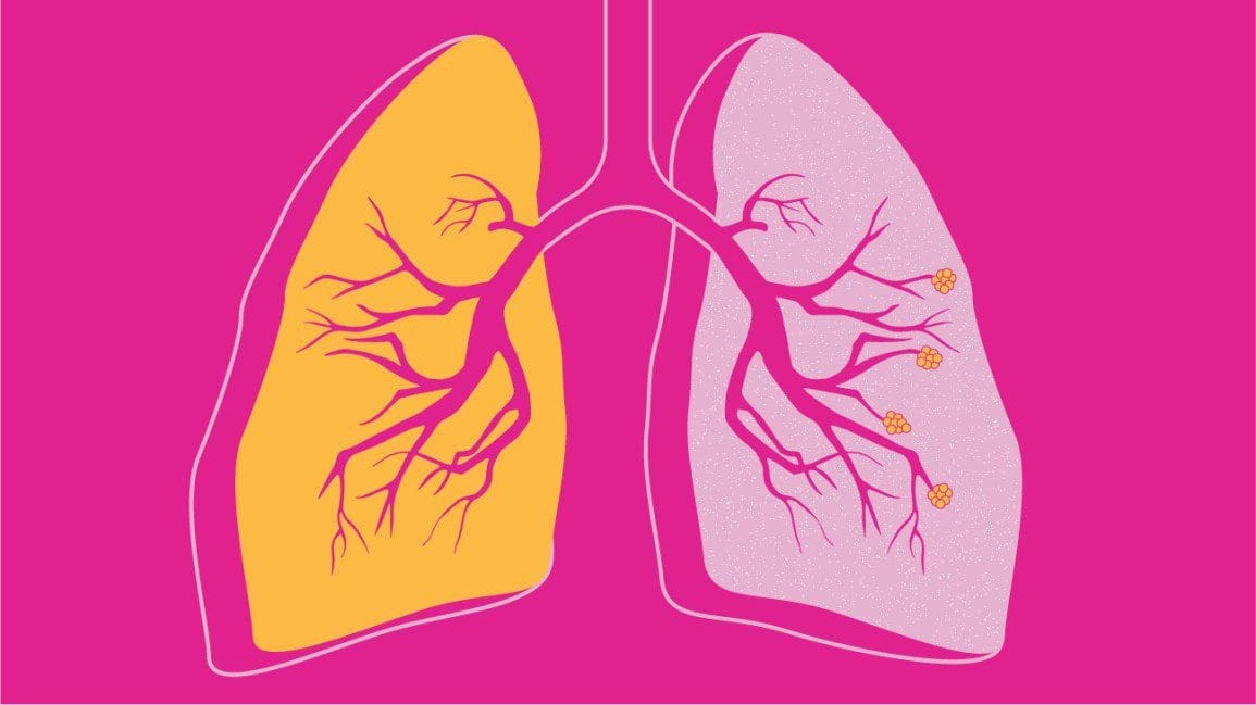 9133 COPD Facts Statistics and You 1296x728 Header
