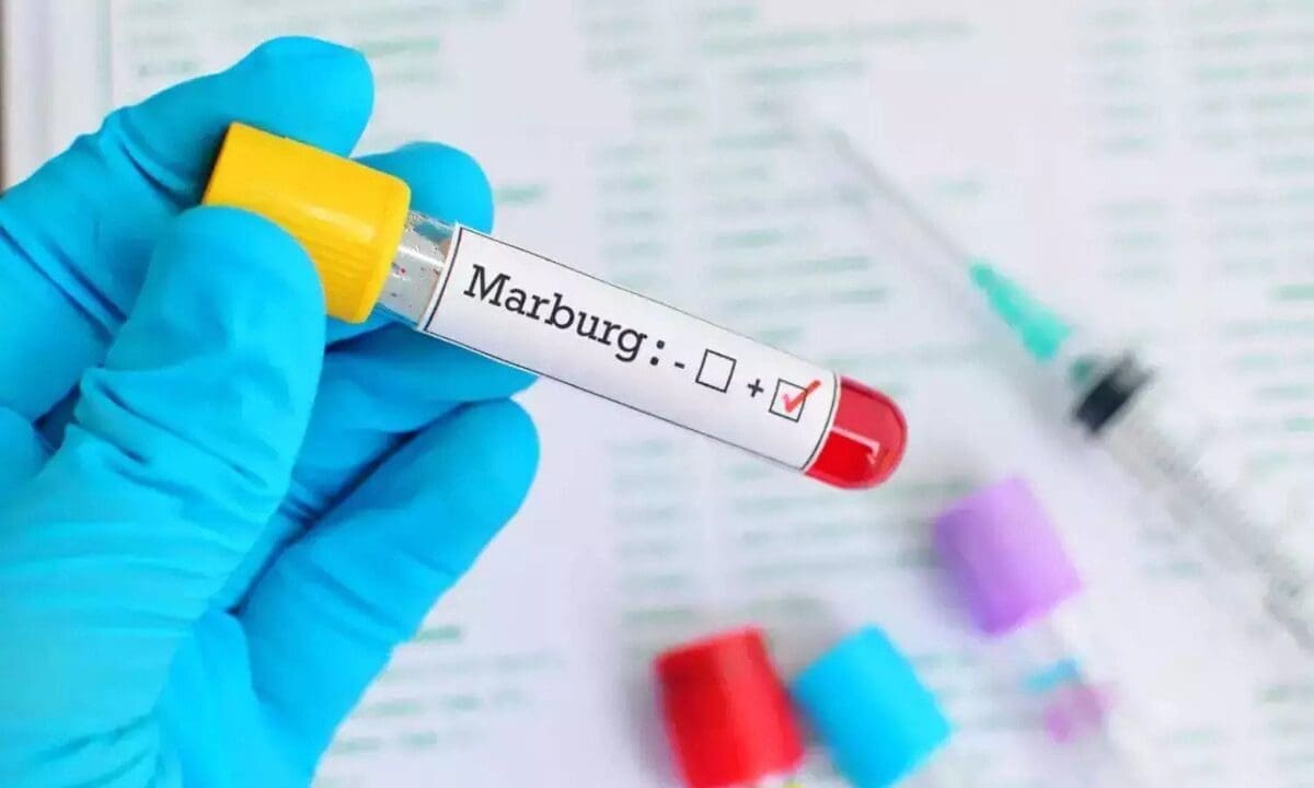 marburg