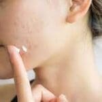 சருமத்தில் உள்ள தழும்புகளை நீக்கும் கோகோ பட்டர் ! 3 download 14 1 5