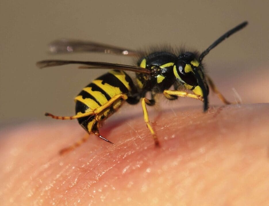 What to Do if Youve Been Stung by a Wasp or Bee scaled
