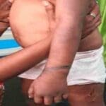 5 வயது சிறுமி சித்திரவதை: தாயின் கள்ளக்காதலன் கொடூரம்! - சந்தேக நபர் தலைமறைவு! 5 image 1843c289c1