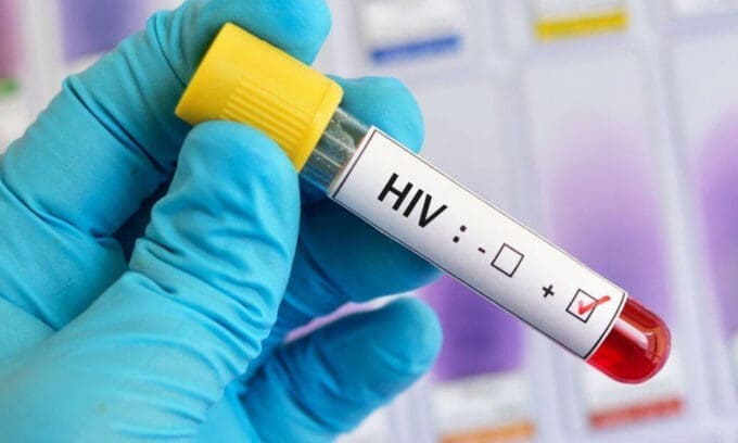HIV 1200px 22 10 26 1000x600 1