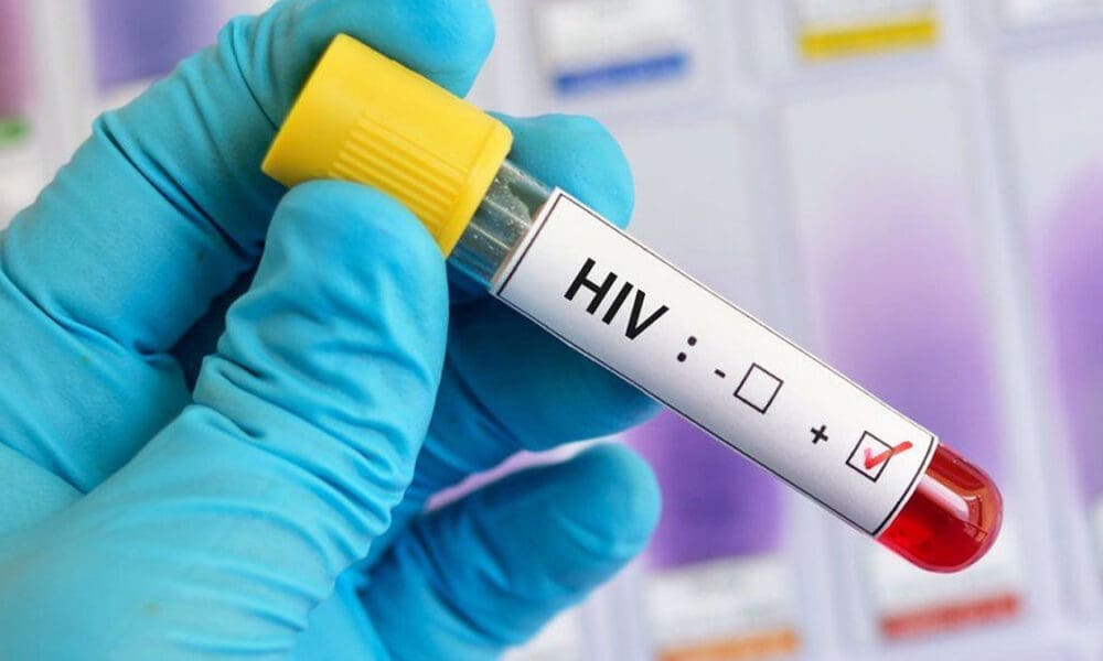 HIV 1200px 22 10 26 1000x600 1