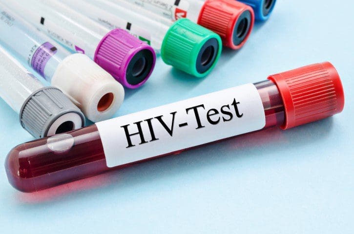 01 HIV AIDS