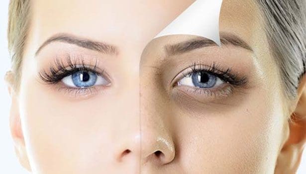 201809061021279331 black circles under eyes reasons SECVPF