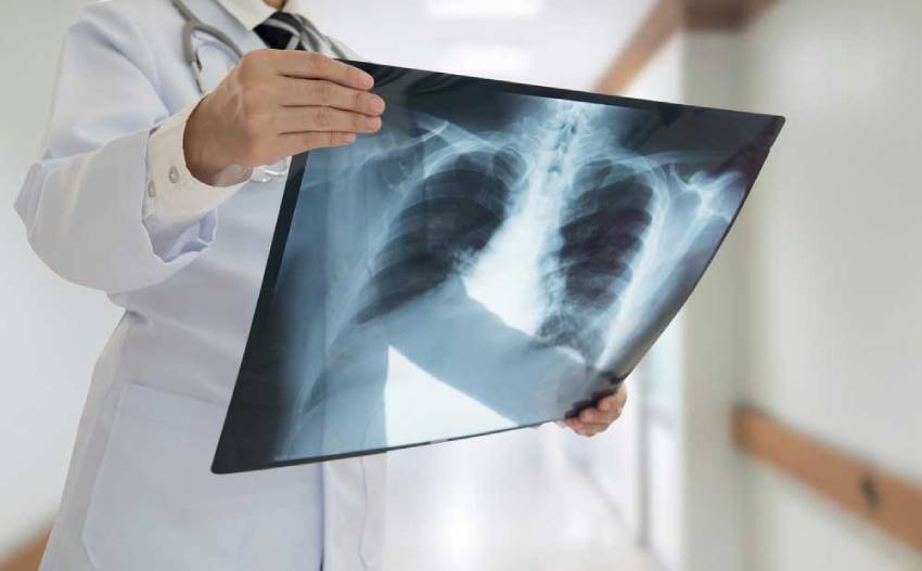 X ray