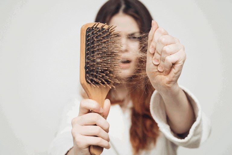 Hair Loss 768x513 1