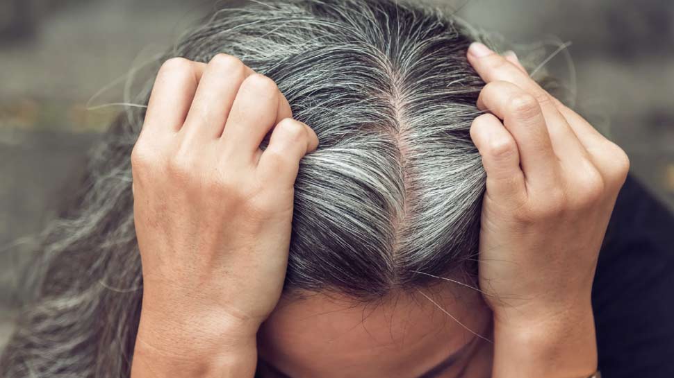 1148161 white hair
